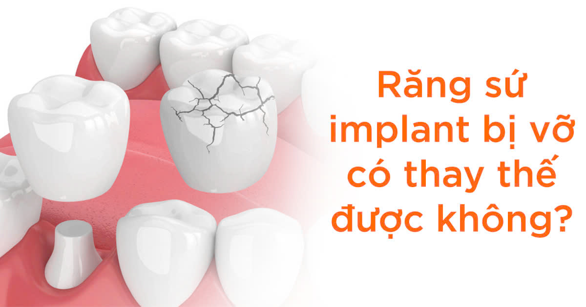 Răng sứ implant bị vỡ có thay thế được không?