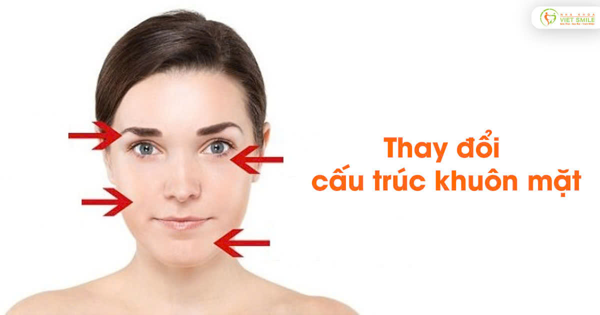 Thay đổi cấu trúc khuôn mặt