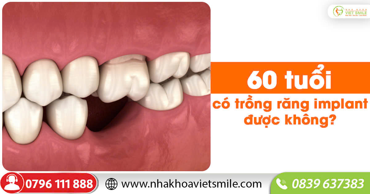 60 tuổi có trồng răng implant được không?