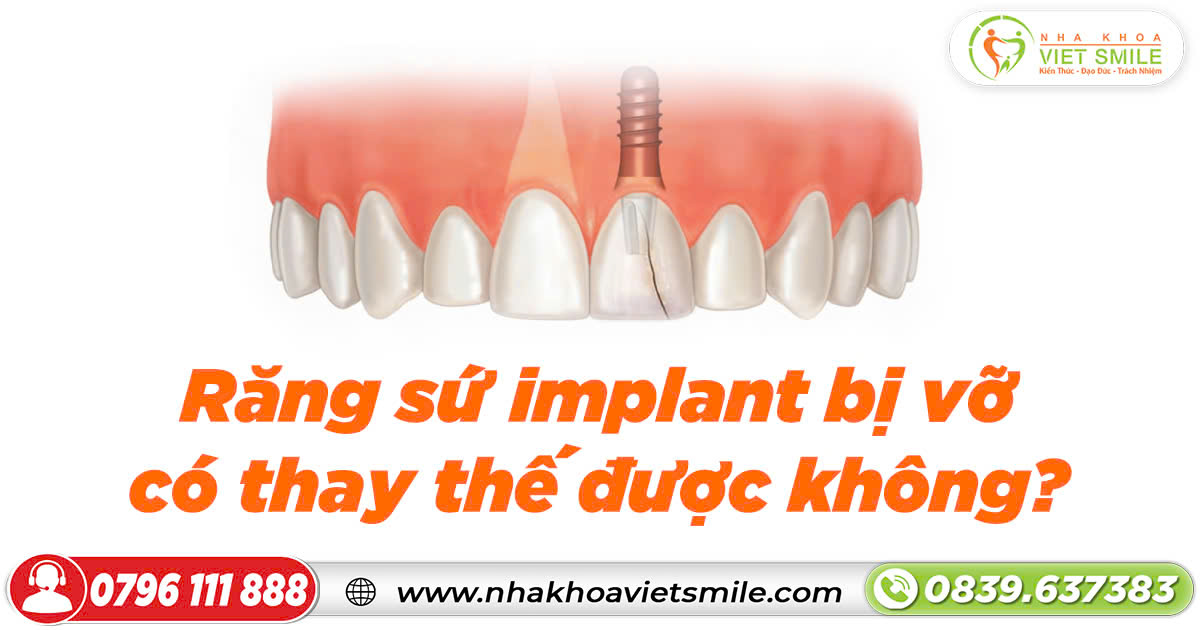 Răng sứ implant bị vỡ có thay thế được không?