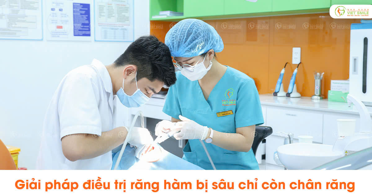 Giải pháp điều trị răng hàm bị sâu chỉ còn chân răng