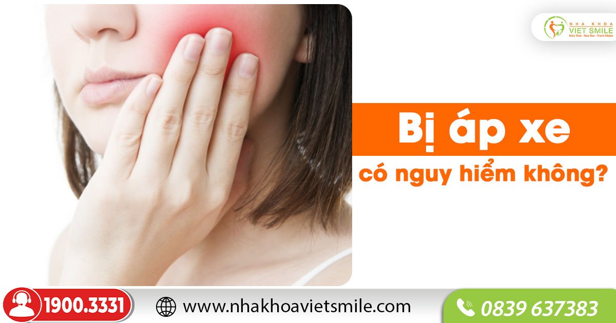 Bị áp xe có nguy hiểm không?