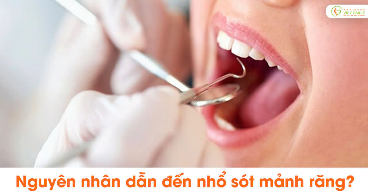 Nguyên nhân dẫn đến nhổ sót mảnh răng?