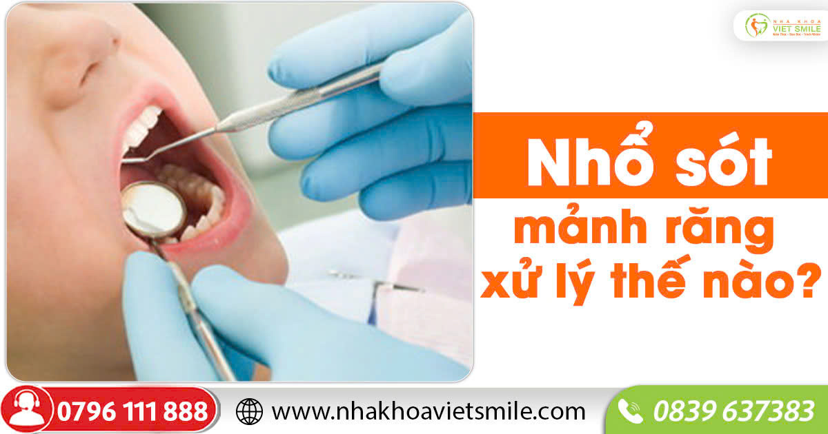 Nhổ sót mảnh răng xử lý thế nào?