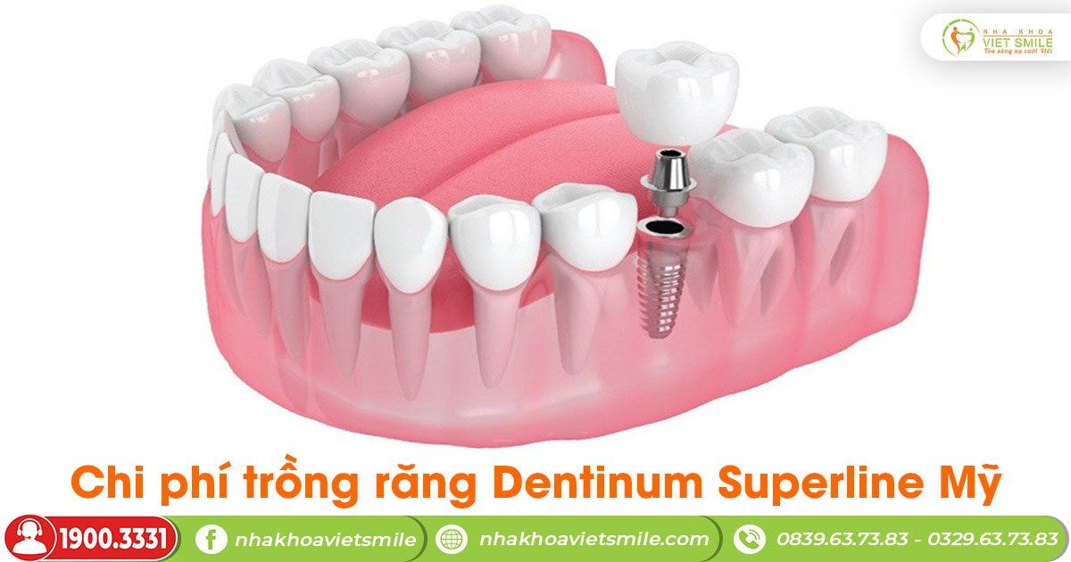 Chi phí trồng răng dentinum superline mỹ