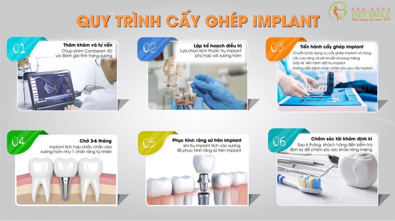 Quay trình cấy trụ dentium implant
