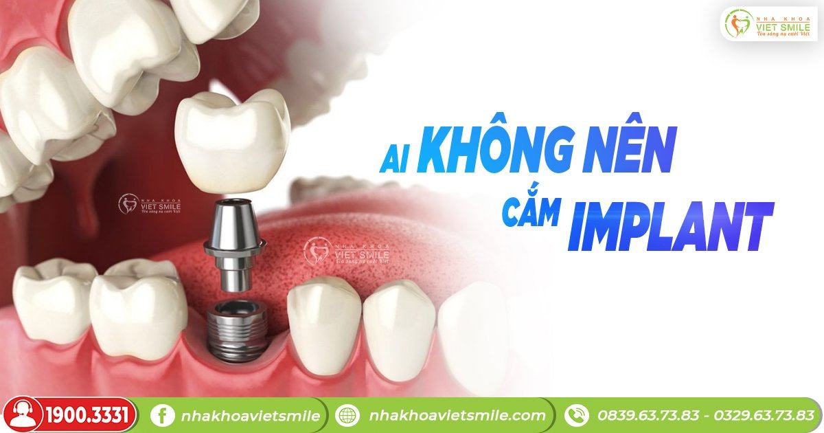 Ai không nên cắm ghép răng implant