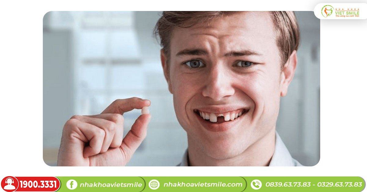 Gãy răng cửa làm giảm khả năng ăn nhai