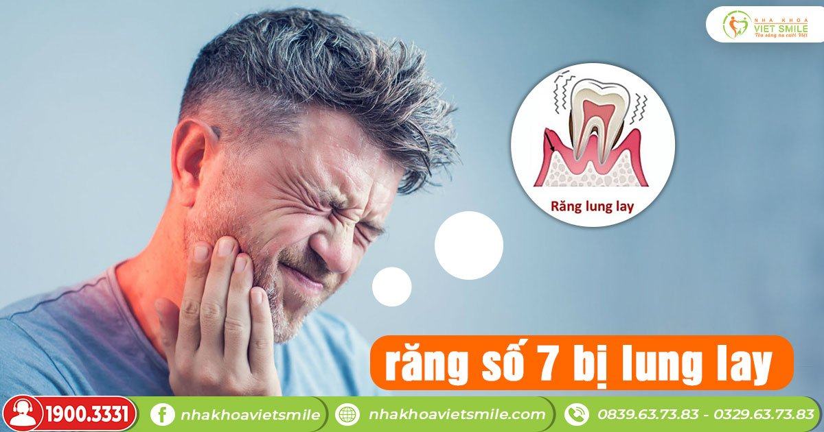 Răng hàm số 7 lung lay
