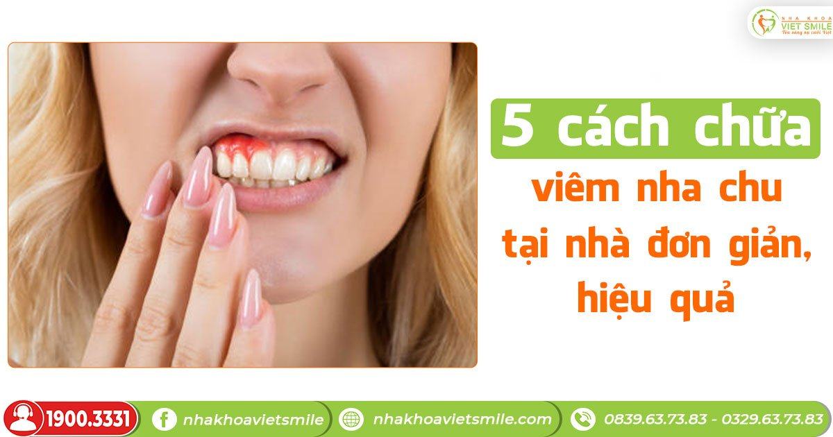 5 cách chữa viêm nha chu răng tại nhà đơn giản, hiệu quả