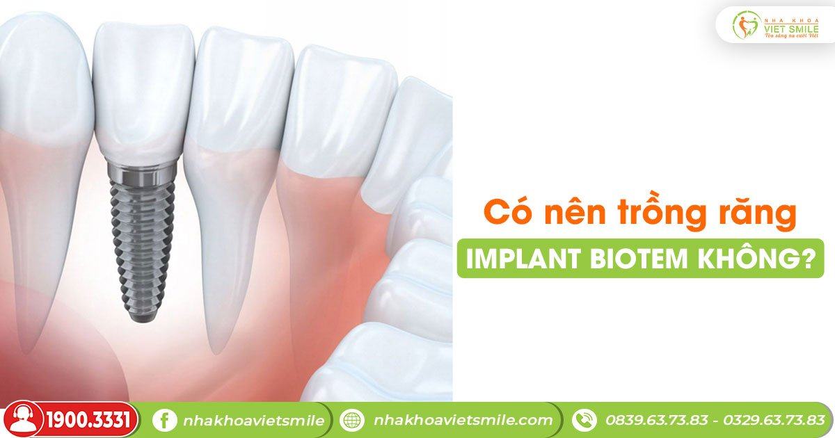 Có nên trồng răng implant biotem không?