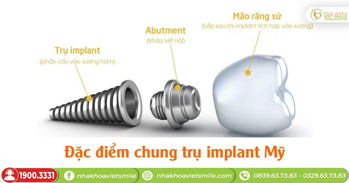 Đặc điểm chung trụ implant mỹ