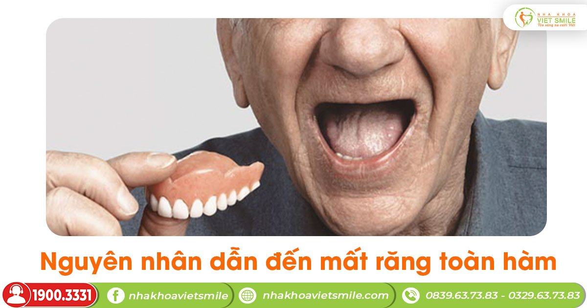 Nguyên nhân dẫn đến mất răng toàn hàm