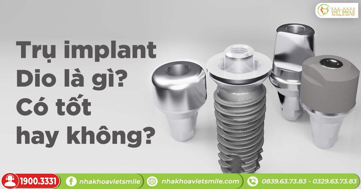 Trụ implant dio là gì và có tốt hay không?