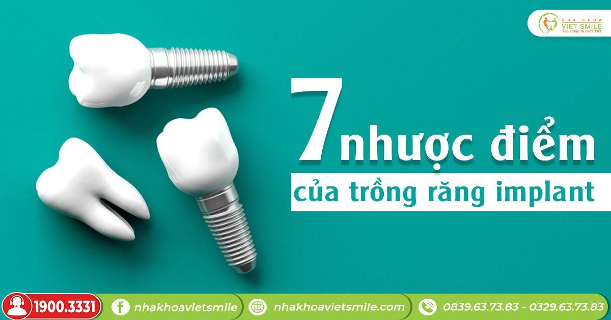 7 nhược điểm của trồng răng implant