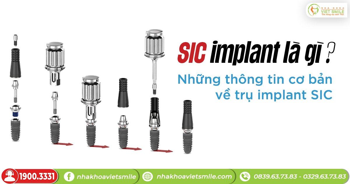 Sic implant là gì? Những thông tin cơ bản về trụ implant sic
