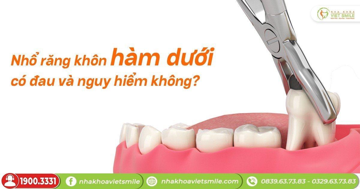 Nhổ răng khôn hàm dưới có đau và nguy hiểm không?