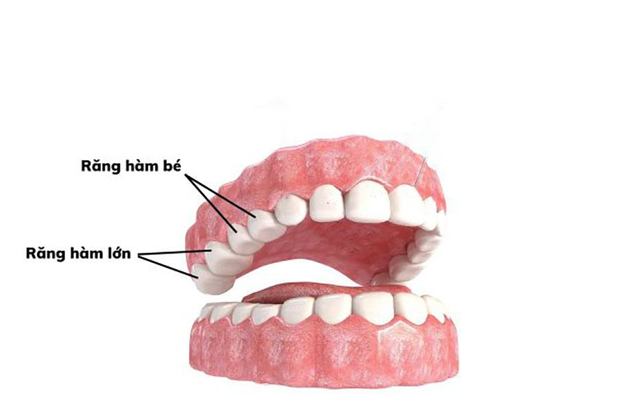 Răng hàm bị sâu có thay được không?