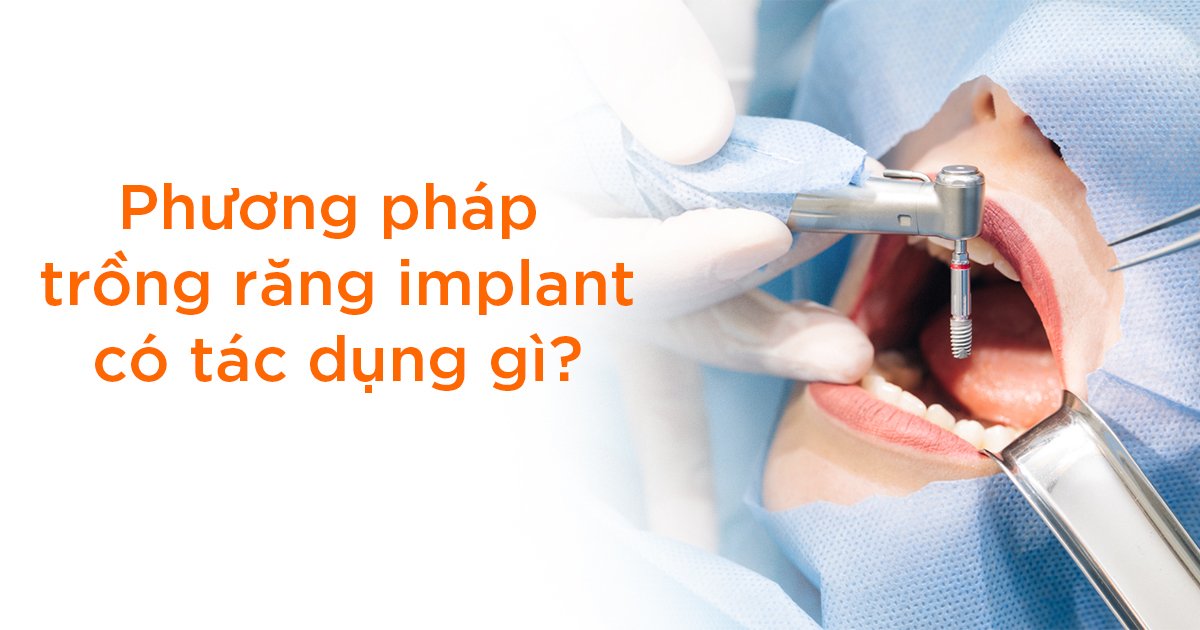 Phương pháp trồng răng implant có tác dụng gì?