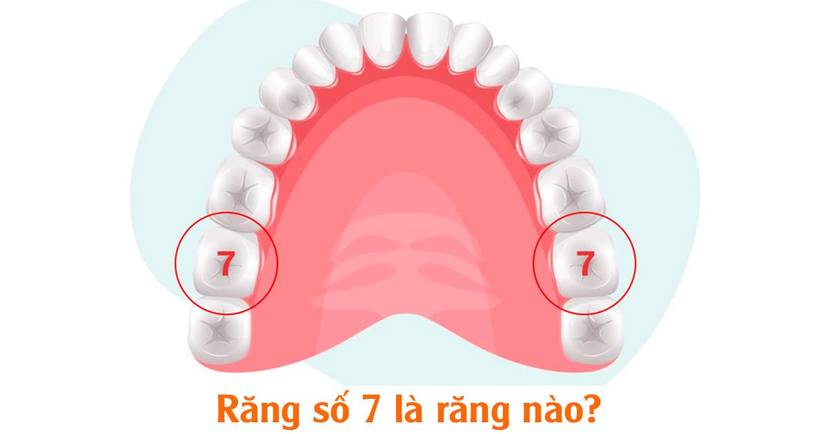 Răng số 7 là răng nào?