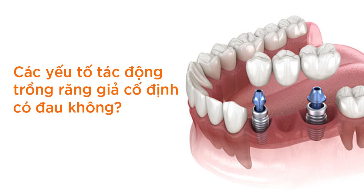 Các yếu tố tác động trồng răng giả cố định có đau không?