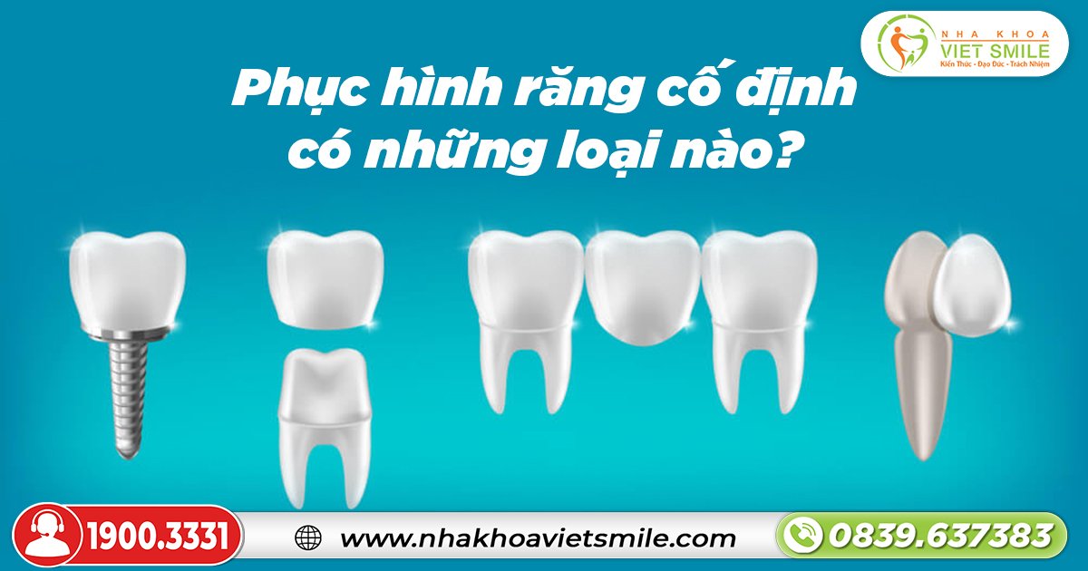 Phục hình răng cố định có những loại nào?