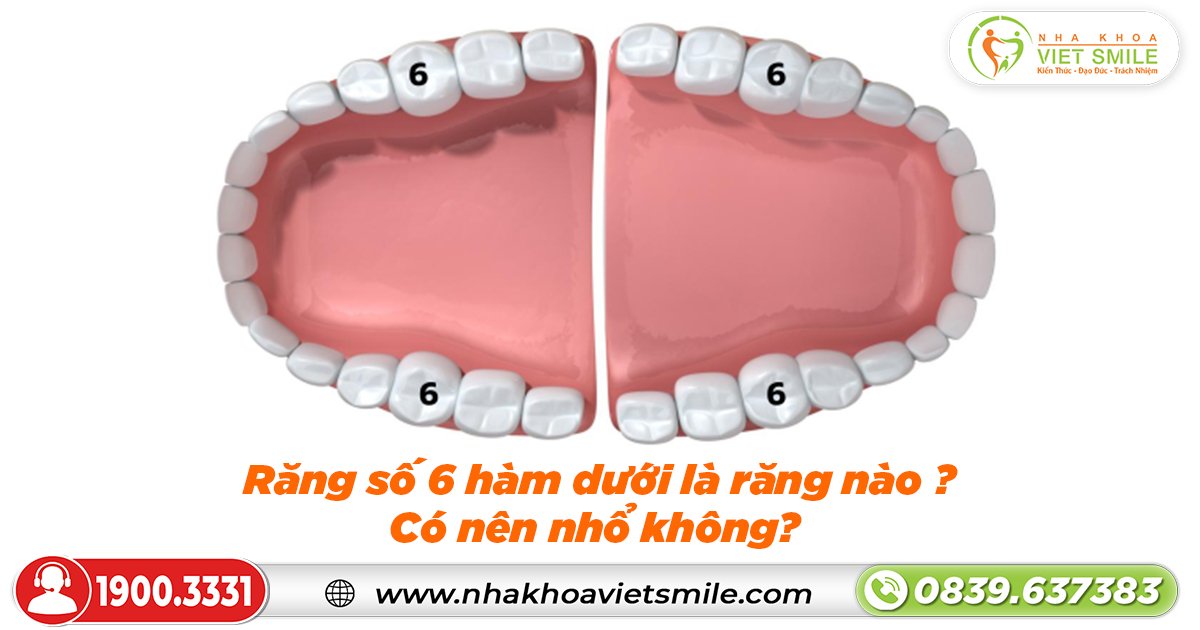 Răng số 6 hàm dưới là răng nào? Có nên nhổ không?
