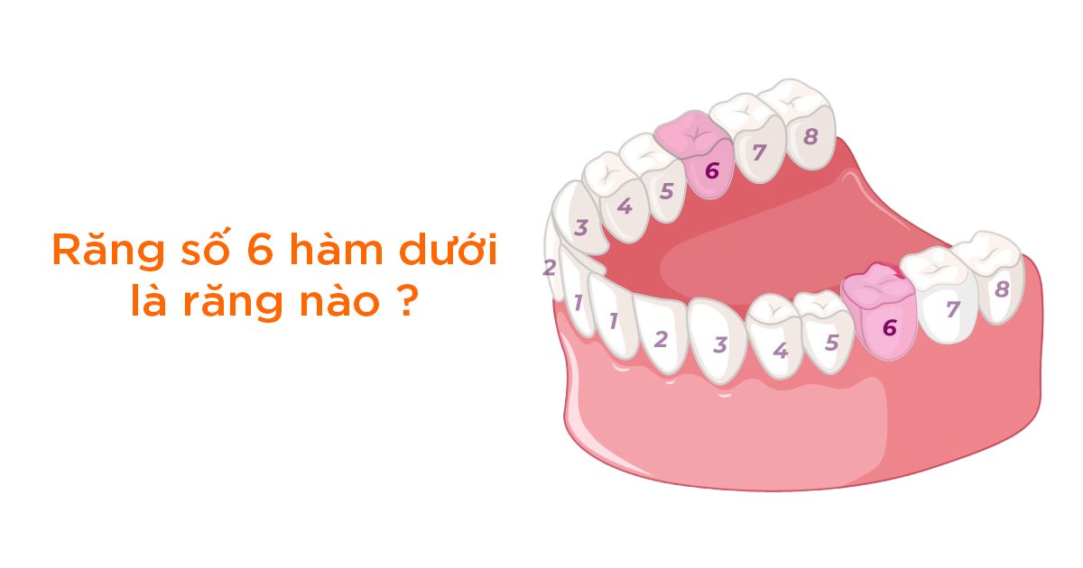 Răng số 6 hàm dưới là răng nào?