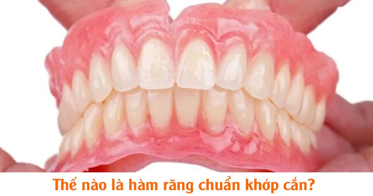 Thế nào là hàm răng chuẩn khớp cắn?