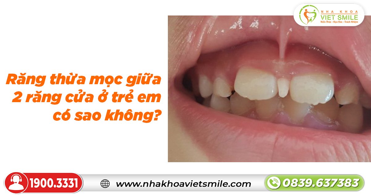 Răng thừa mọc giữa 2 răng cửa ở trẻ em có sao không?