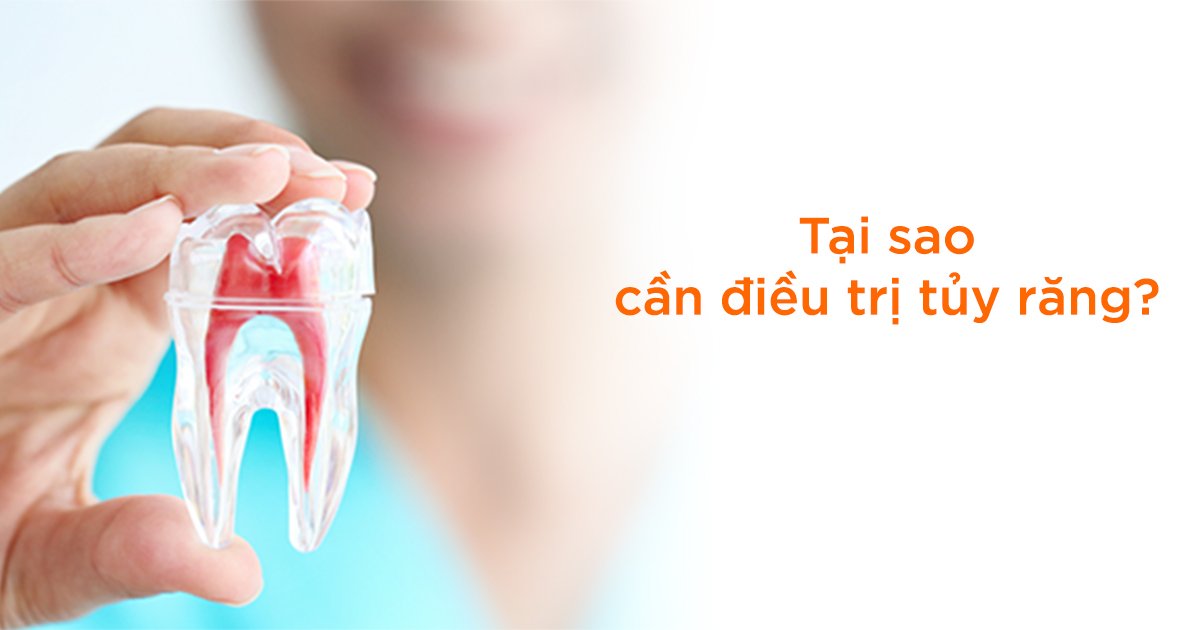 Tại sao cần điều trị tủy răng?