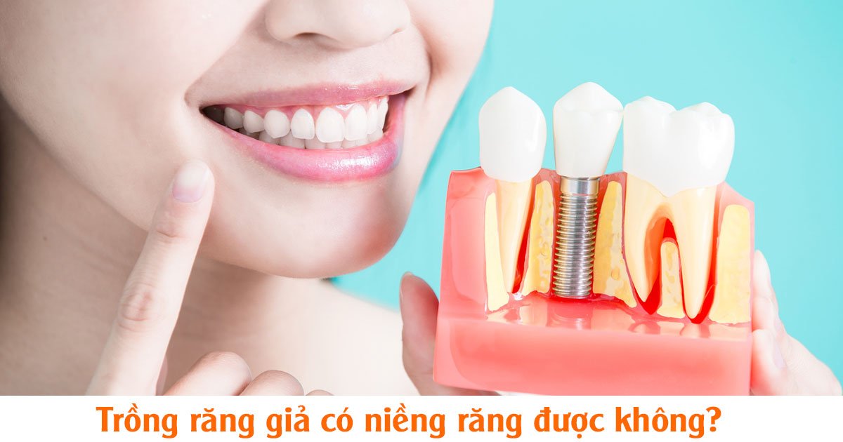 Trồng răng giả có niềng răng được không? 3 Trồng răng giả có niềng răng được không?