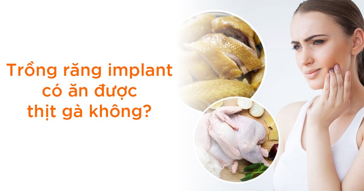 Trồng răng Implant có ăn được thịt gà không?