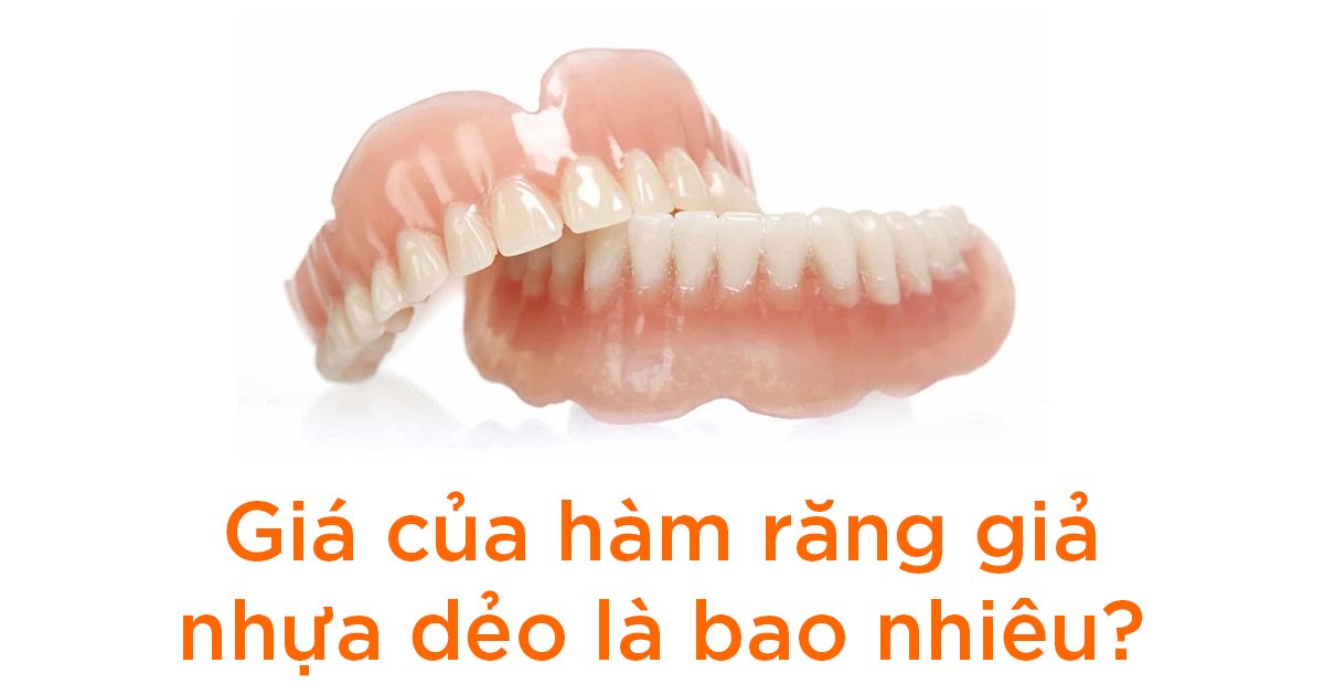Giá của hàm răng giả nhựa dẻo là bao nhiêu?