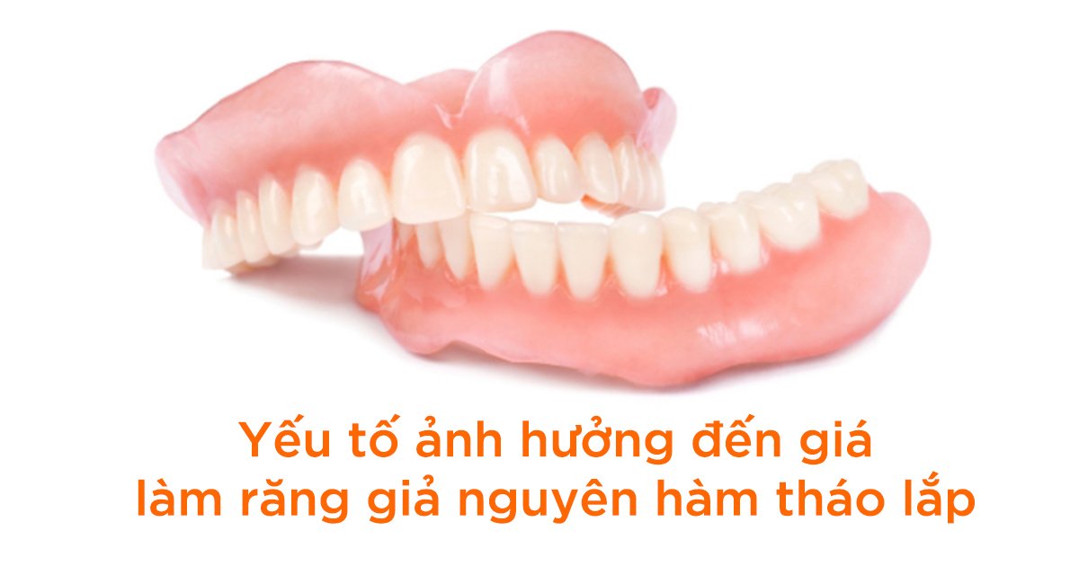 Yếu tố ảnh hưởng đến giá làm răng giả nguyên hàm tháo lắp