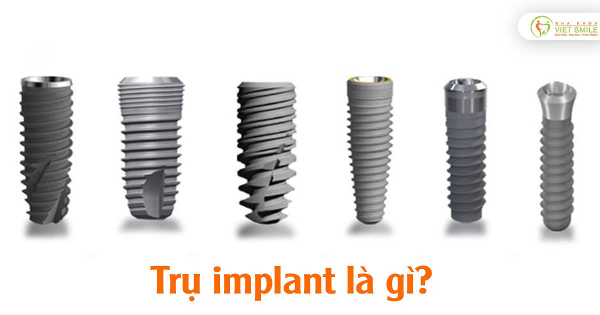 Trụ implant là gì?