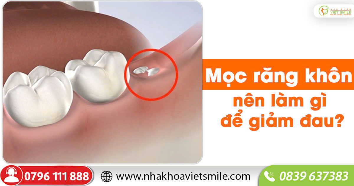 Mọc răng khôn nên làm gì để giảm đau?