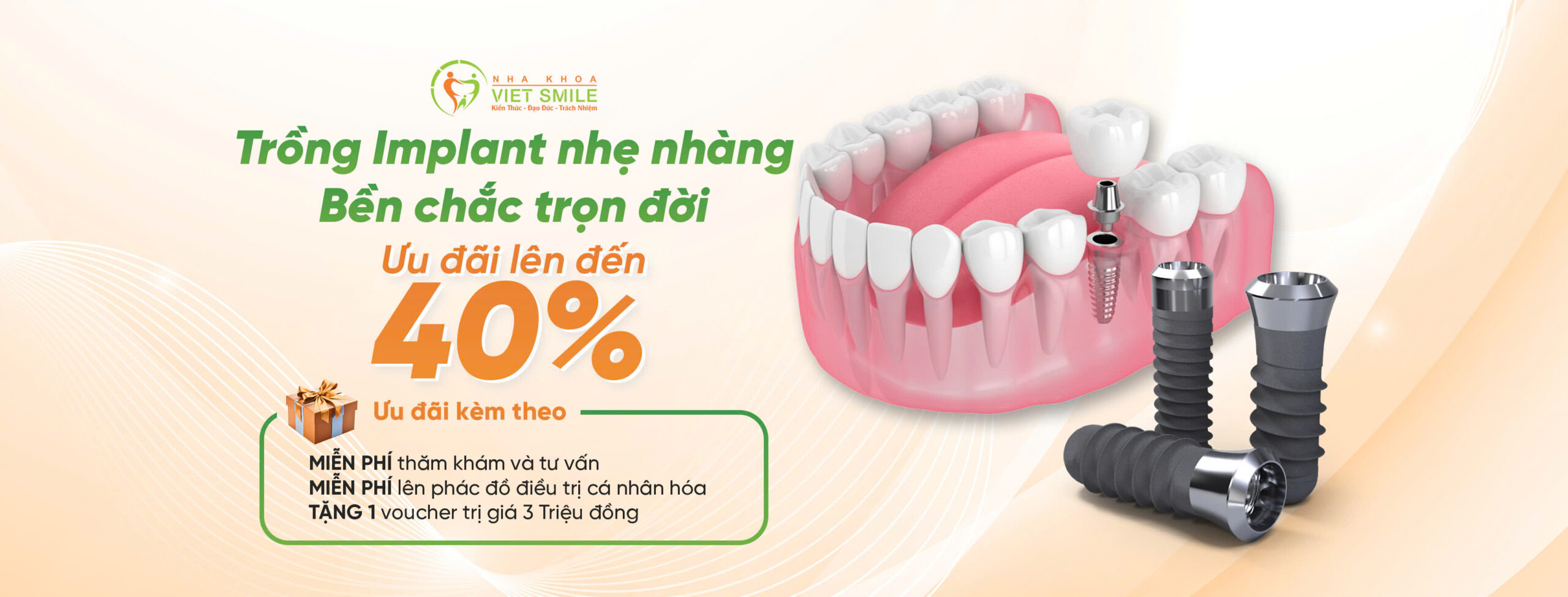 vietsmile uu dai implant thang 7 scaled