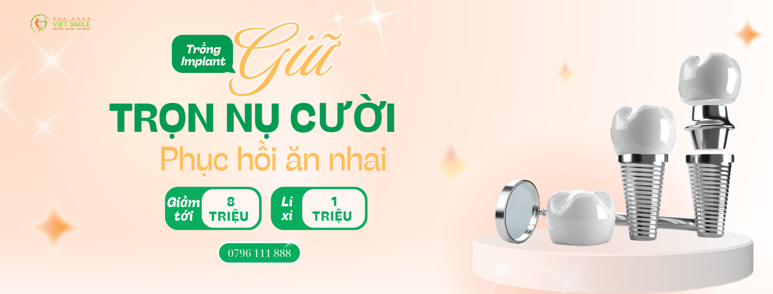 Ưu đãi trồng răng Implant